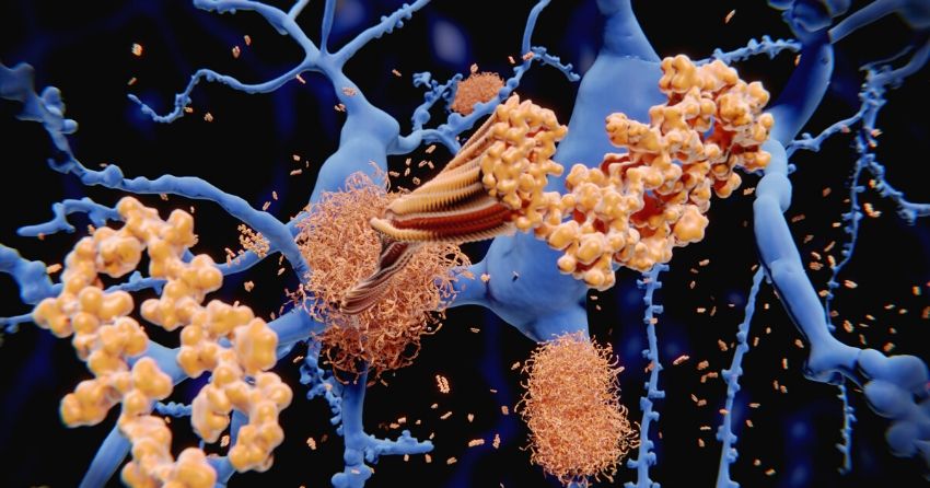 high calcium levels in the mitochondria increase neuronal death and contribute to amyloid plaque buildup in Alzheimer's disease