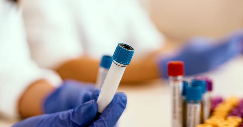 blood testing at the lab