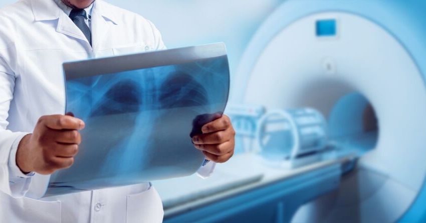 doctor holding an xray