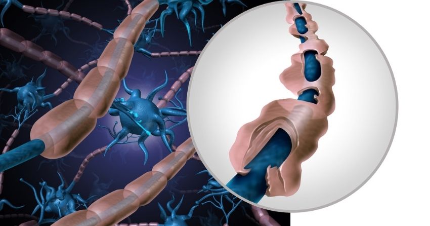 Researchers Identify a Molecule to Rejuvenate Myelin in Aged Brains