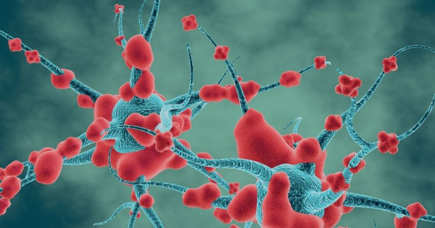 neurons, brain cells, parkinsons disease