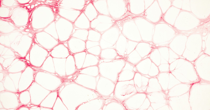 A Mitochondrial Protein May Influence How Cells Burn or Store Fuel
