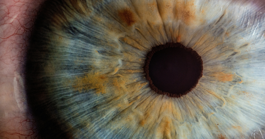 The Longevity Secret Hiding in a Shark's Eyeball