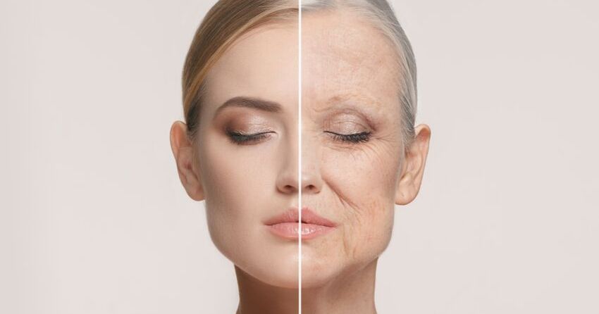 aging skin