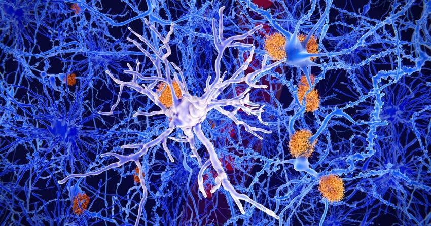 Researchers Use Novel Gene Regulation Therapy to Treat Alzheimer's in Mice