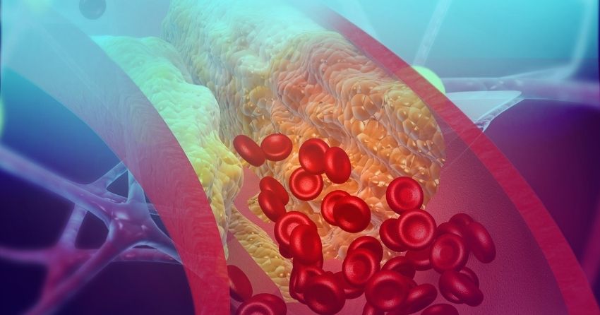 Age-Related Blood Vessel Calcification and Bone Loss Share Physiological Mechanisms