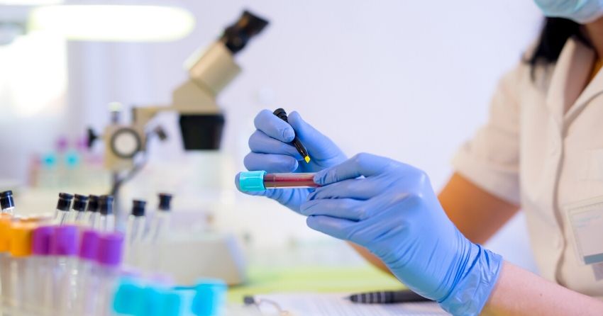 First Non-Invasive Biomarker Tracks Efficacy of Senolytics