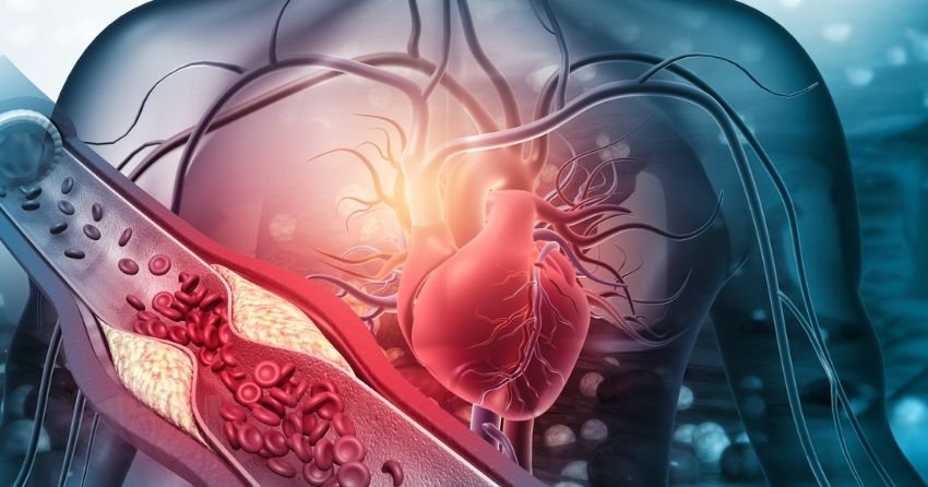 NMN Staves Off Blood Vessel Cell Aging Underlying Cardiovascular Diseases In Mice, Study Shows