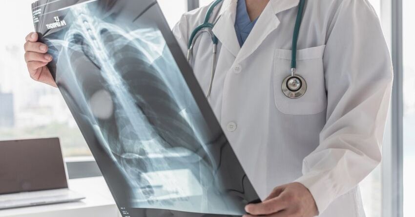 doctor with lung cancer scan