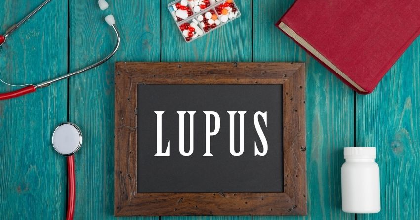 Successfully Treating Lupus by Targeting Plasma, Small Study Finds