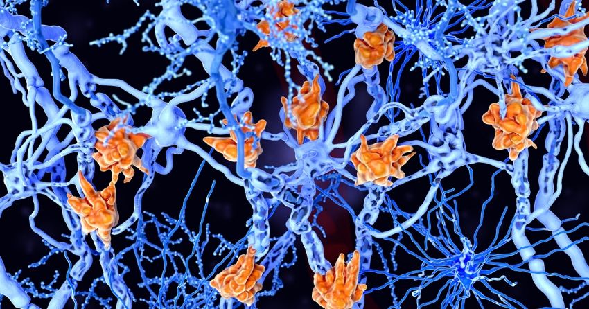 myelin sheath; Potential New Therapeutic Options For Multiple Sclerosis