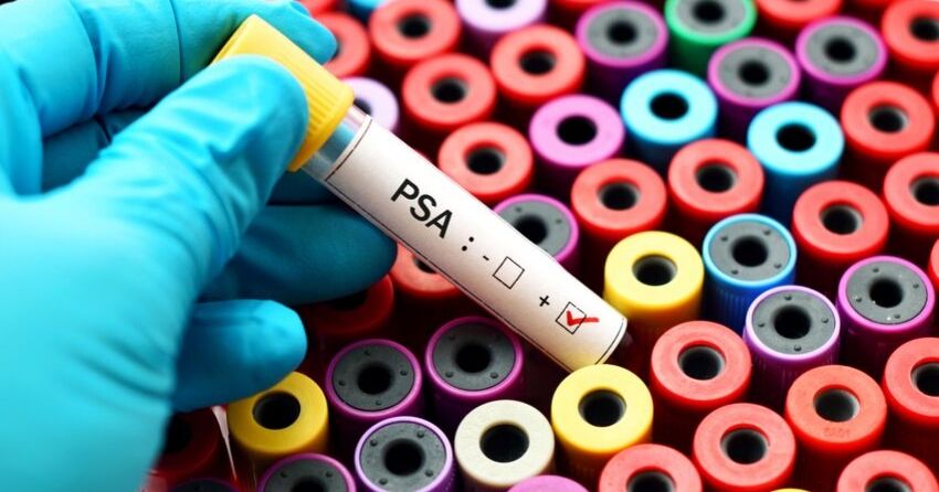 psa test for prostate cancer