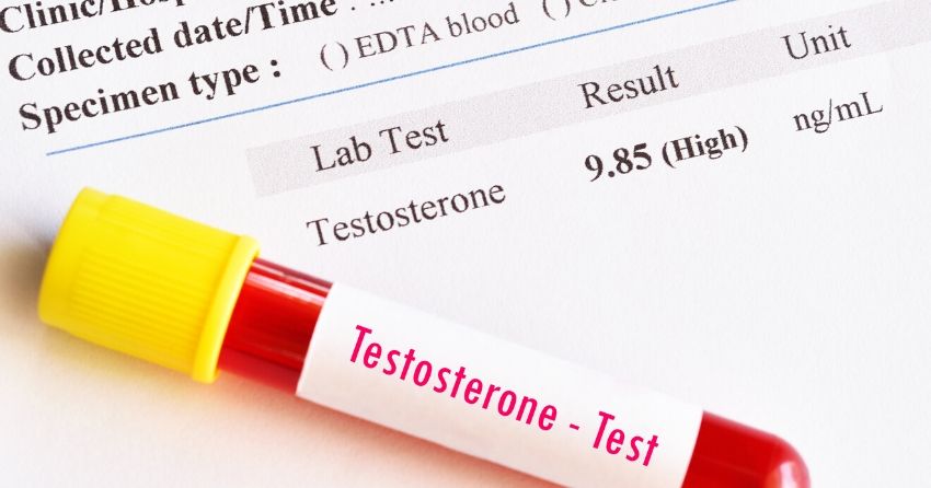 bloodwork, testosterone lab, high testosterone