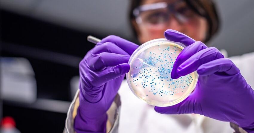 woman doing bacterial culture microbiome
